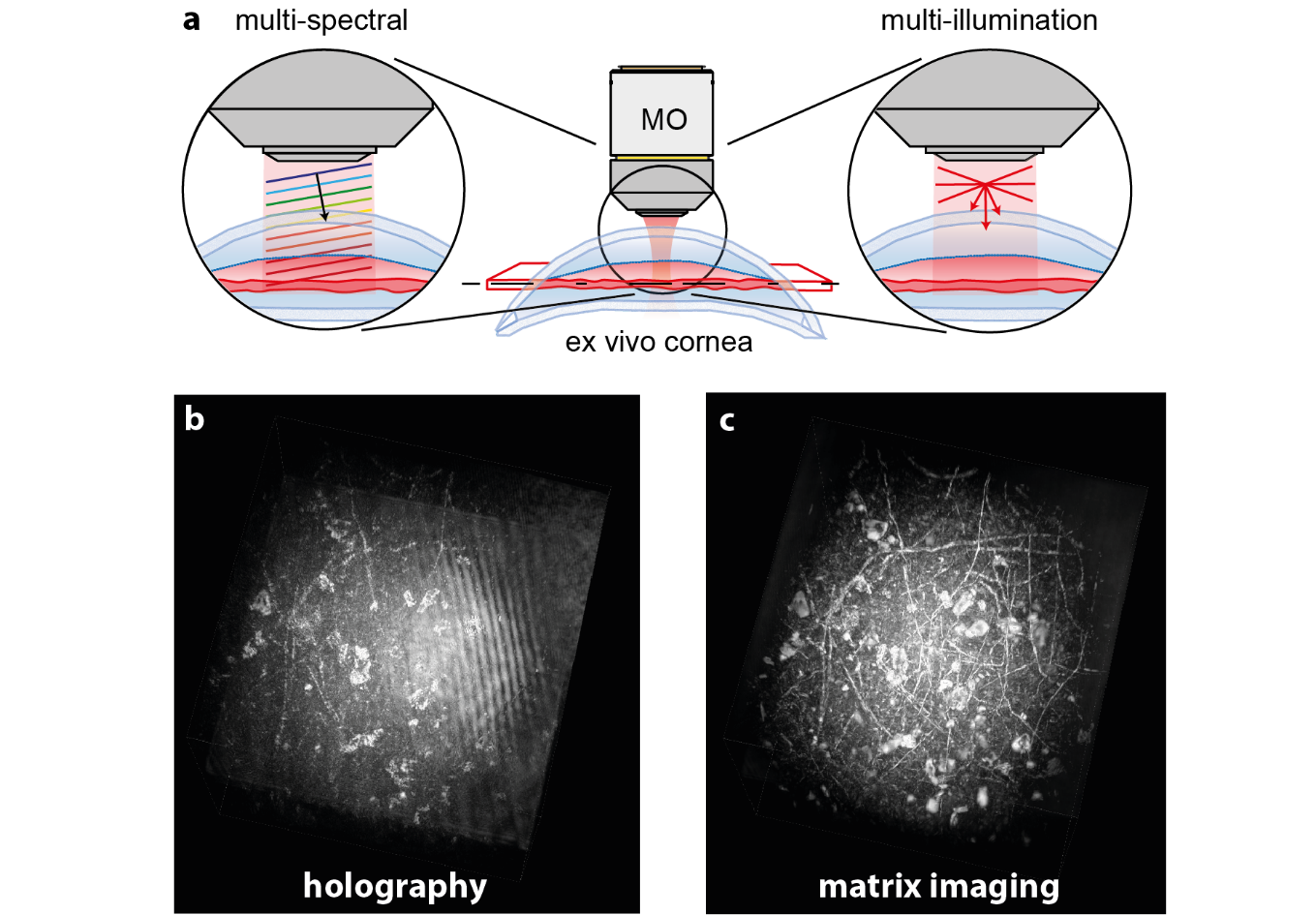 Le microscope matriciel : un changement de paradigme pour l’imagerie en profondeur des tissus biologiques